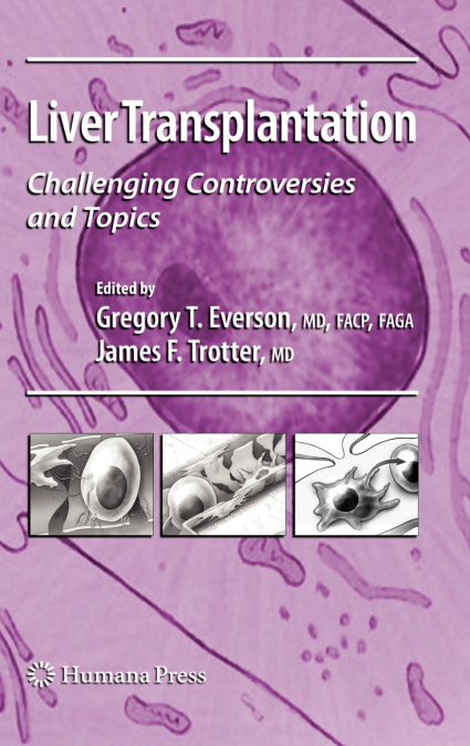 Liver Transplantation