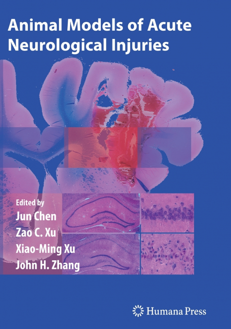Animal Models of Acute Neurological Injuries