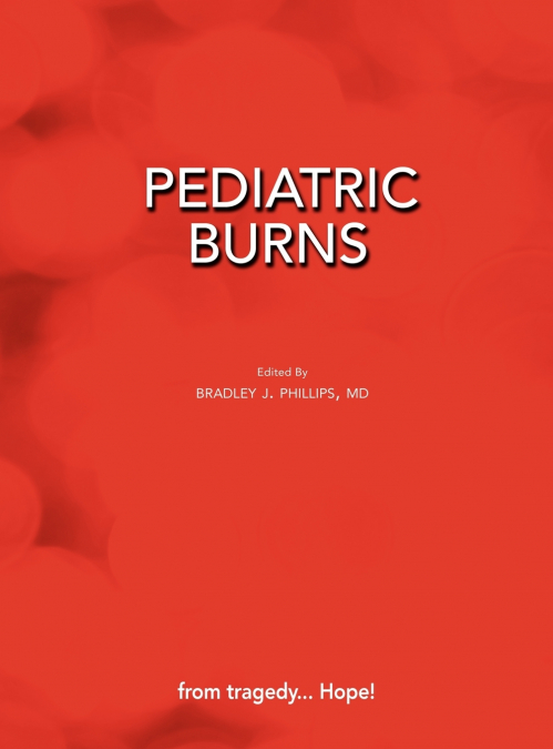 Pediatric Burns