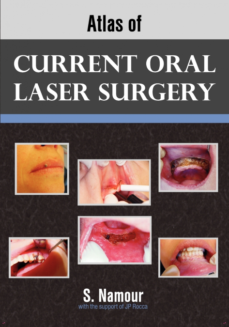 Atlas of Current Oral Laser Surgery