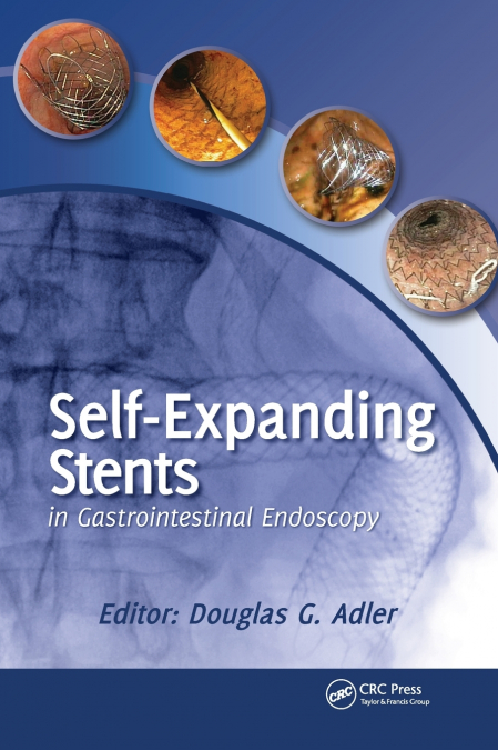 Self-Expanding Stents in Gastrointestinal Endoscopy