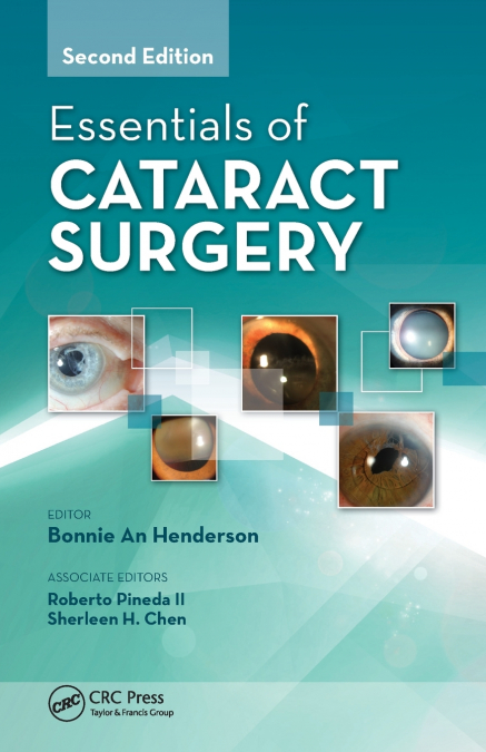 Essentials of Cataract Surgery