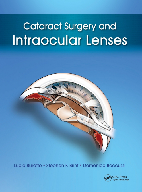 Cataract Surgery and Intraocular Lenses
