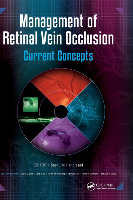 Management of Retinal Vein Occlusion