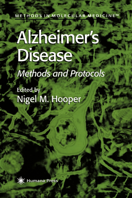 Alzheimer’s Disease