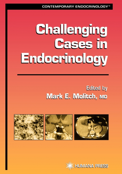 Challenging Cases in Endocrinology