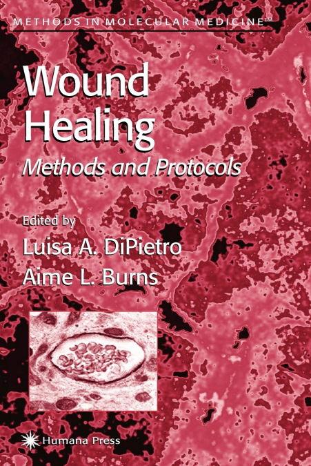 Wound Healing