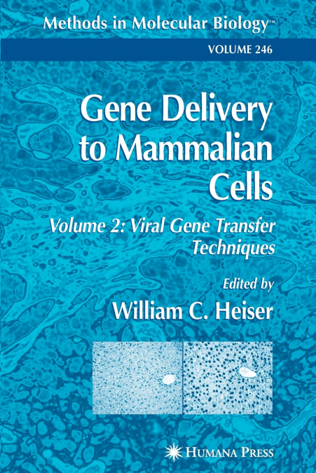 Gene Delivery to Mammalian Cells