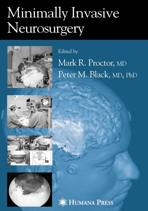 Minimally Invasive Neurosurgery