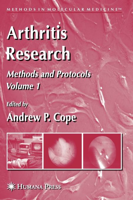 Arthritis Research