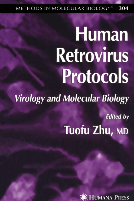 Human Retrovirus Protocols