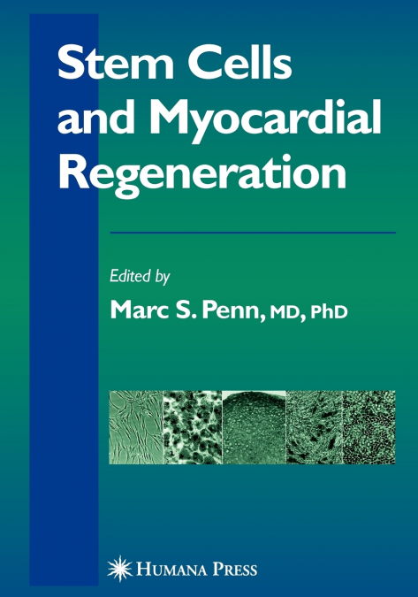 Stem Cells and Myocardial Regeneration