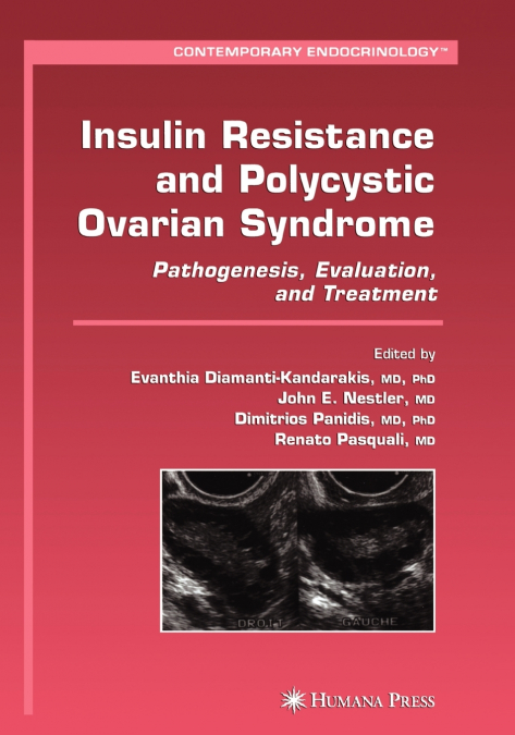 Insulin Resistance and Polycystic Ovarian Syndrome