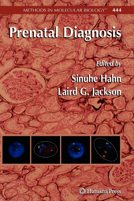 Prenatal Diagnosis