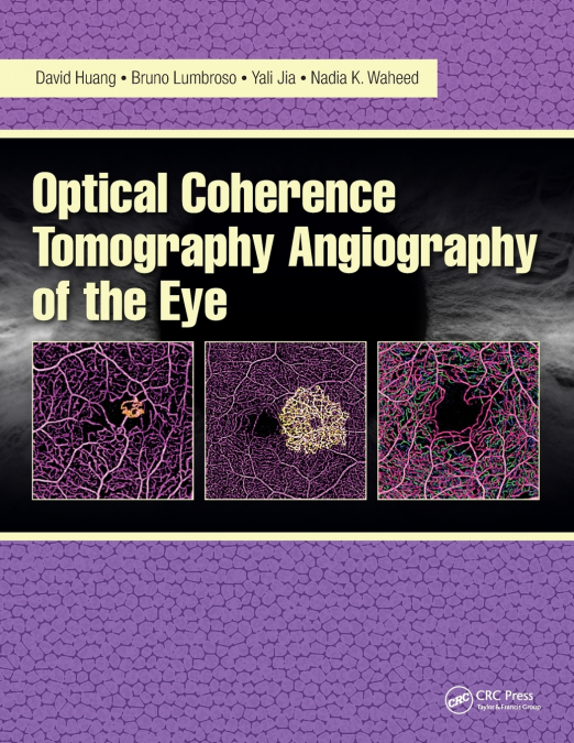 Optical Coherence Tomography Angiography of the Eye