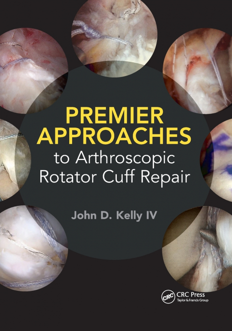 Premier Approaches to Arthroscopic Rotator Cuff Repair