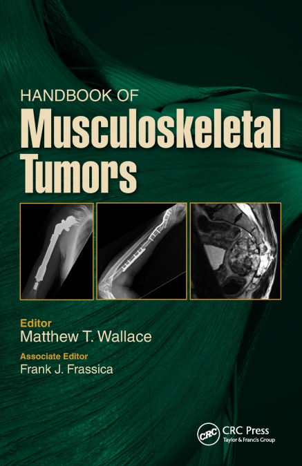 Handbook of Musculoskeletal Tumors