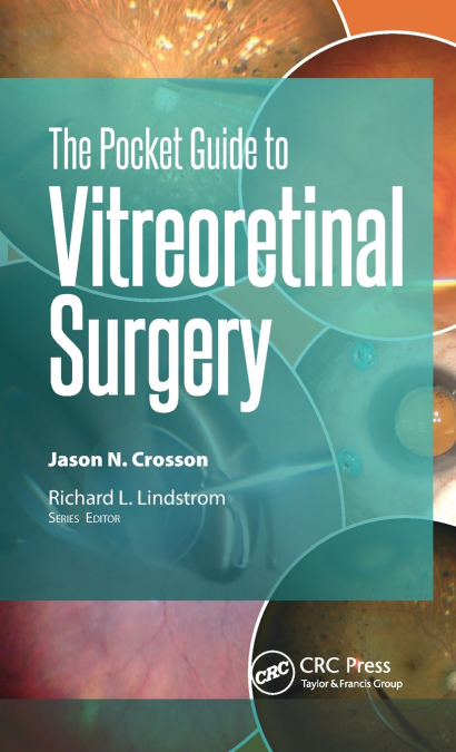 The Pocket Guide to Vitreoretinal Surgery