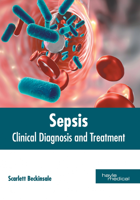 Sepsis