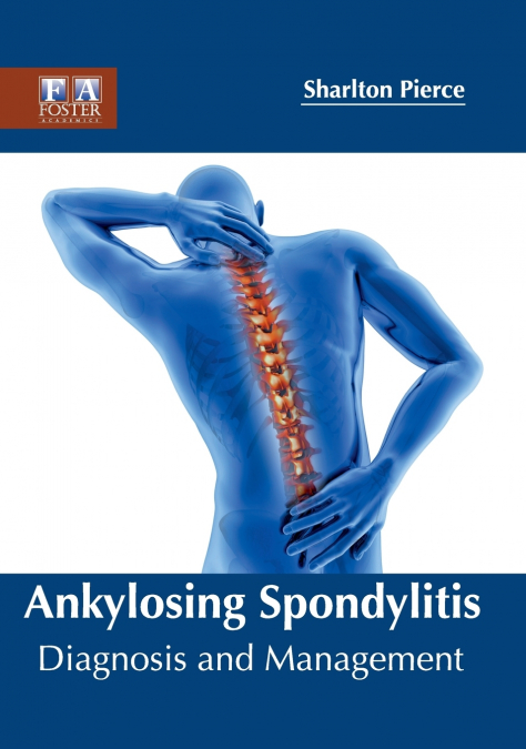Ankylosing Spondylitis