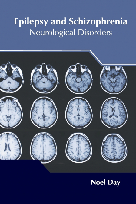 Epilepsy and Schizophrenia