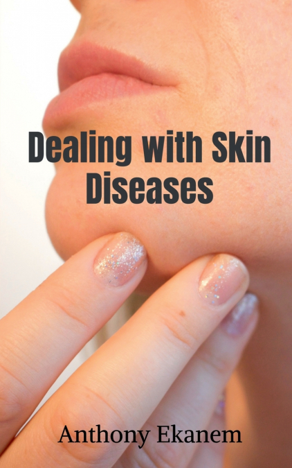 Dealing with Skin Diseases