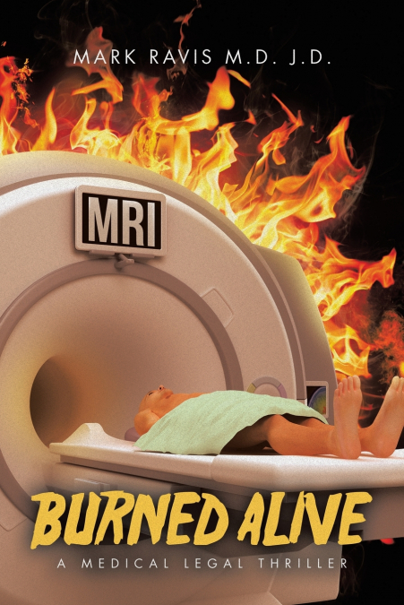 Burned Alive