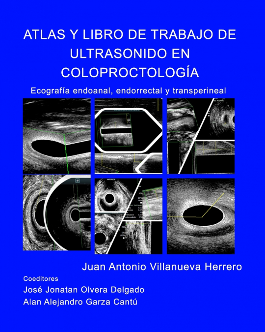 Atlas y Libro de Trabajo de Ultrasonido en Coloproctología