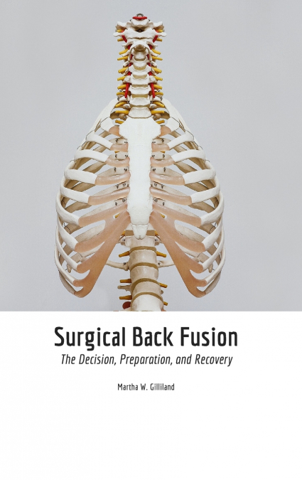Surgical Back Fusion