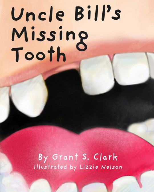 Uncle Bill’s Missing Tooth