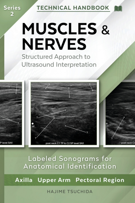 MUSCLES & NERVES - Technical Ultrasound Handbook of the Axilla, Upper Arm and Pectoral Region (Series 2)