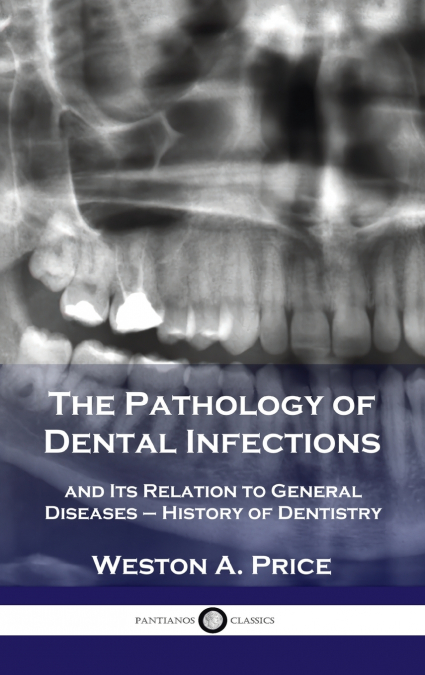 Pathology of Dental Infections