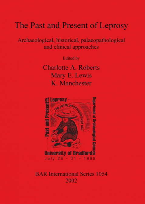 The Past and Present of Leprosy