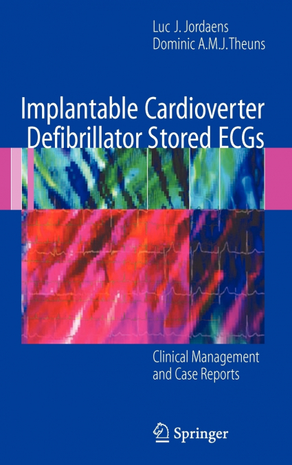 Implantable Cardioverter Defibrillator Stored ECGs