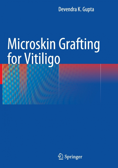 Microskin Grafting for Vitiligo