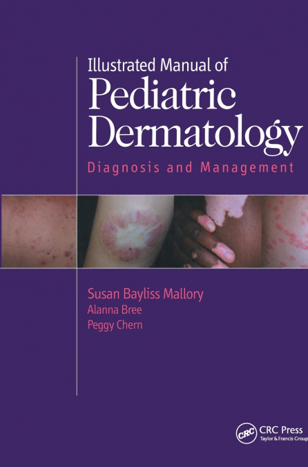 Illustrated Manual of Pediatric Dermatology