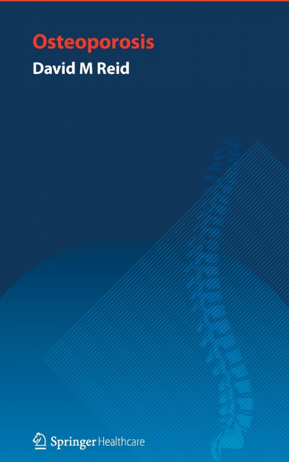 Handbook of Osteoporosis