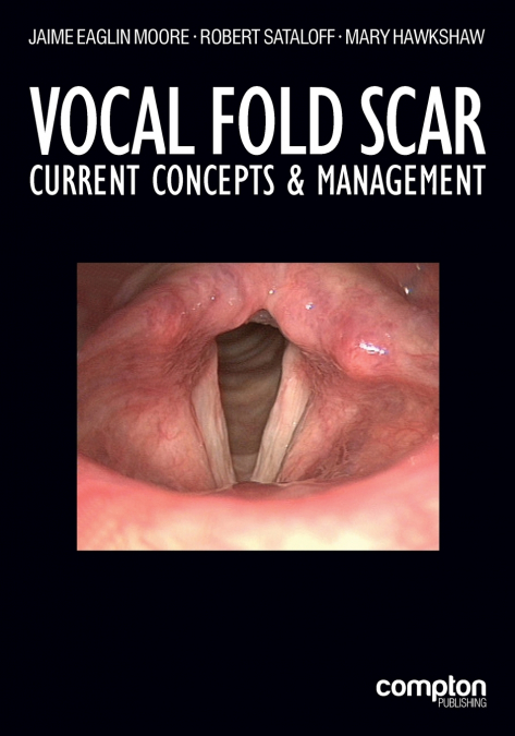 Vocal Fold Scar