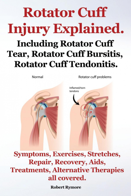 Rotator Cuff Injury Explained. Including Rotator Cuff Tear, Rotator Cuff Bursitis, Rotator Cuff Tendonitis. Symptoms, Exercises, Stretches, Repair, Re