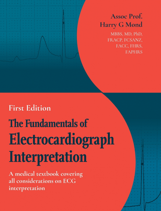 The Fundamentals of Electrocardiograph Interpretation