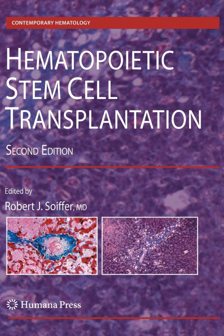 Hematopoietic Stem Cell Transplantation