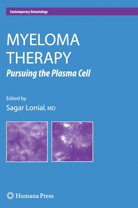 Myeloma Therapy