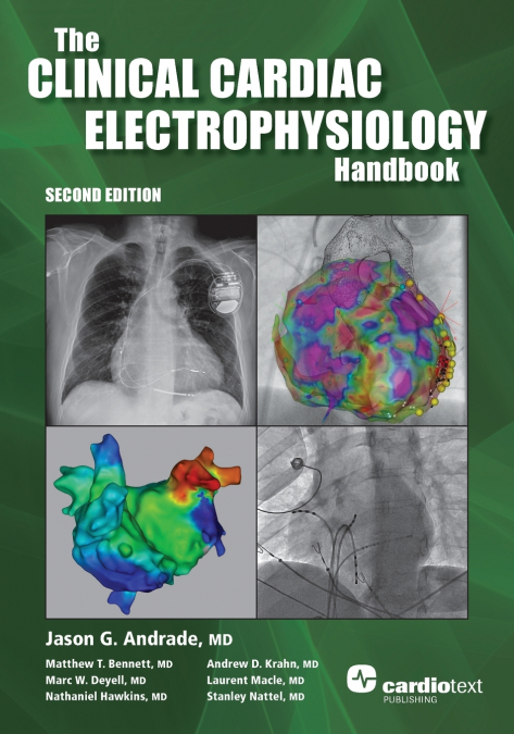 The Clinical Cardiac Electrophysiology Handbook, Second Edition