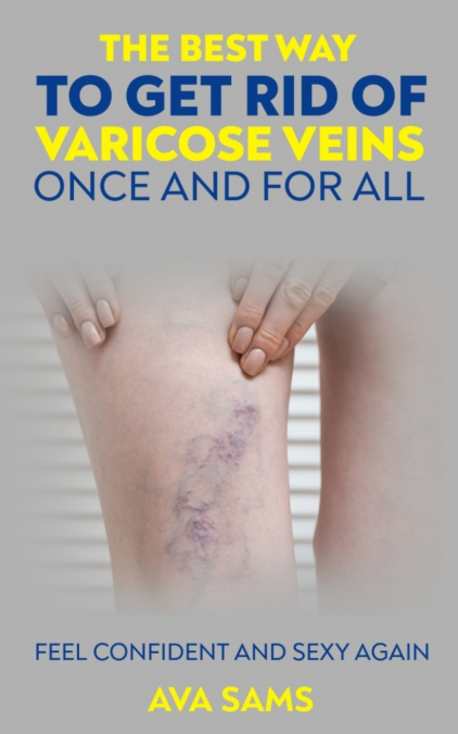 The Best Way to Get Rid of Varicose Veins Once and For All