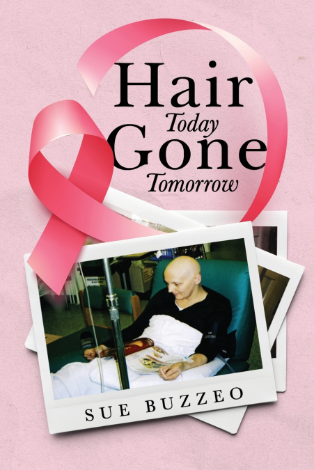Hair Today Gone Tomorrow