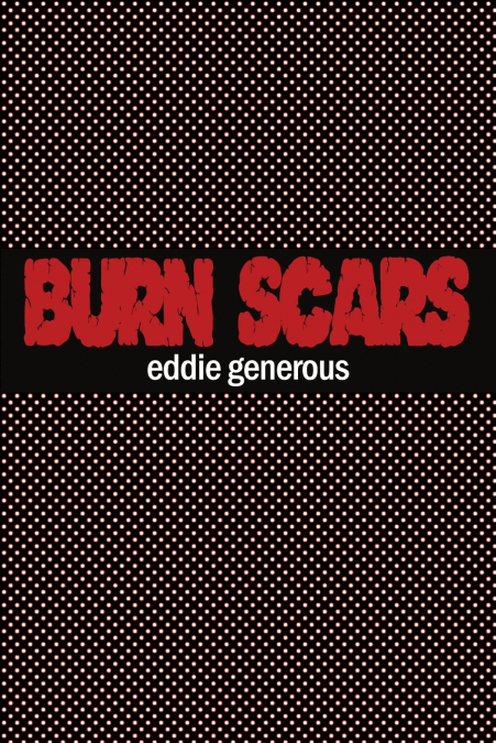 Burn Scars