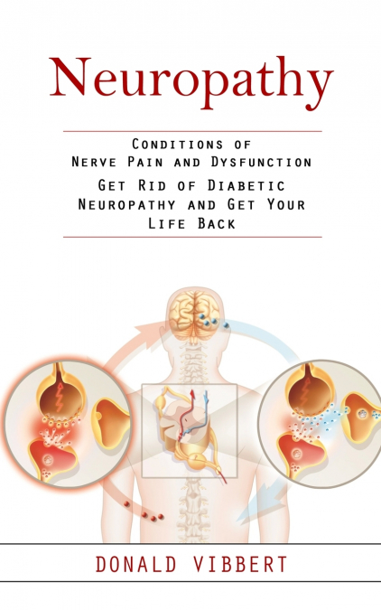 Neuropathy