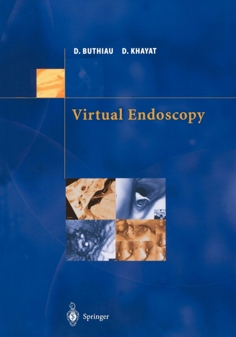Virtual Endoscopy