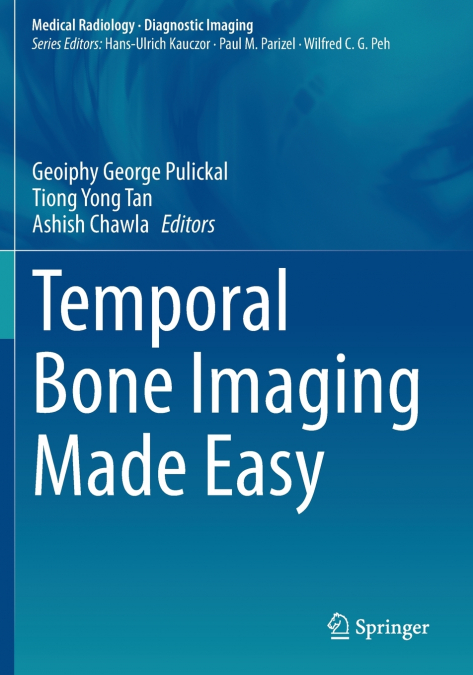 Temporal Bone Imaging Made Easy