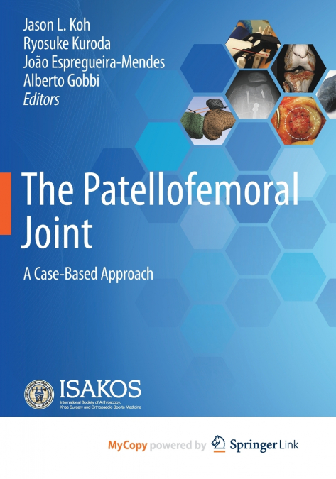 The Patellofemoral Joint